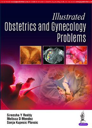 Illustrated Obstetrics and Gynecology Problems by Sireesha Y Reddy