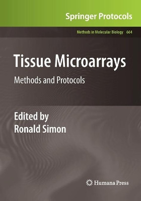 Tissue Microarrays: Methods and Protocols by Ronald Simon 9781493961030