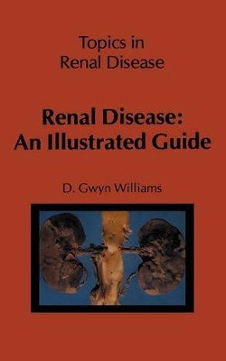 Renal Disease: An Illustrated Guide by D. G. Williams 9789400980686