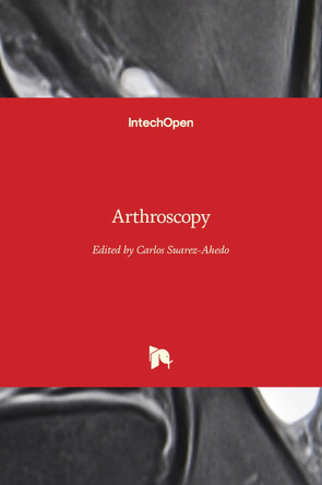 Arthroscopy by Carlos Suarez-Ahedo 9781839694783
