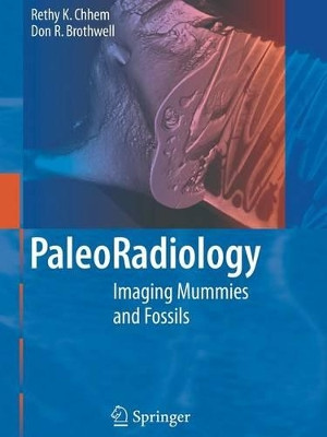 Paleoradiology: Imaging Mummies and Fossils by Rethy K. Chhem 9783642080241