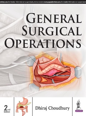 General Surgical Operations by Dhiraj Choudhury 9789351525202