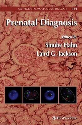 Prenatal Diagnosis by Sinuhe Hahn 9781617377877