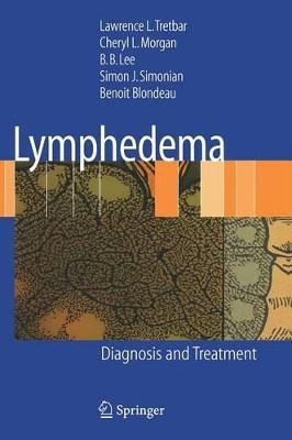 Lymphedema: Diagnosis and Treatment by Lawrence L. Tretbar 9781846285486