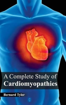 Complete Study of Cardiomyopathies by Bernard Tyler 9781632420091