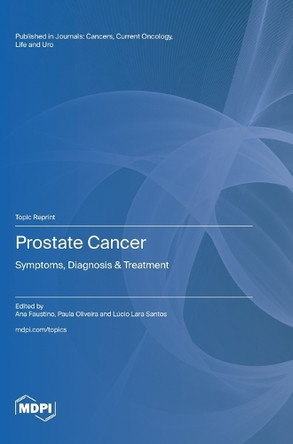 Prostate Cancer: Symptoms, Diagnosis & Treatment by Ana Faustino 9783725827817