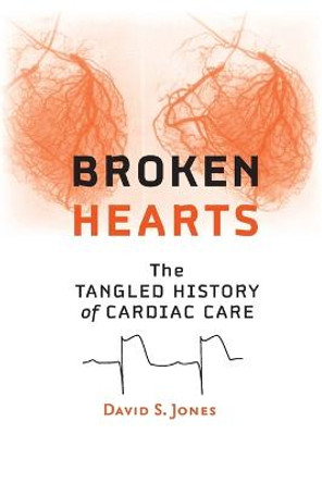 Broken Hearts: The Tangled History of Cardiac Care by David S. Jones