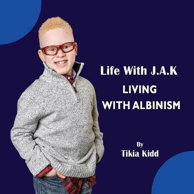 Life With J.A.K Living with Albinism: Living with Albinism 9780997171907
