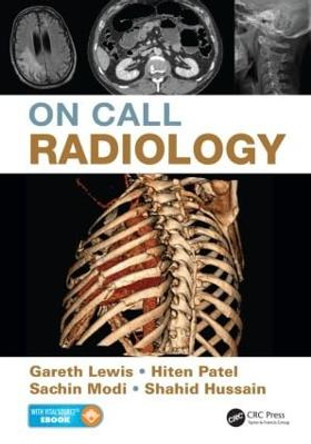 On Call Radiology by Gareth Lewis