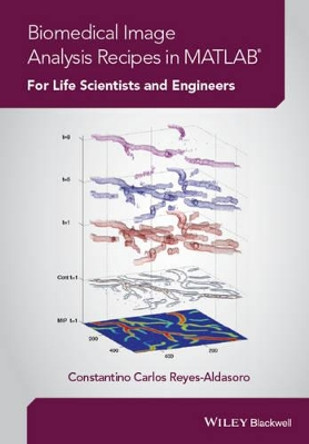 Biomedical Image Analysis Recipes in MATLAB: For Life Scientists and Engineers by Constantino Carlos Reyes-Aldasoro 9781118657553