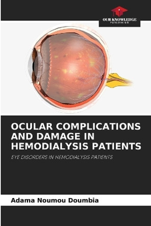 Ocular Complications and Damage in Hemodialysis Patients by Adama Noumou Doumbia 9786207547005