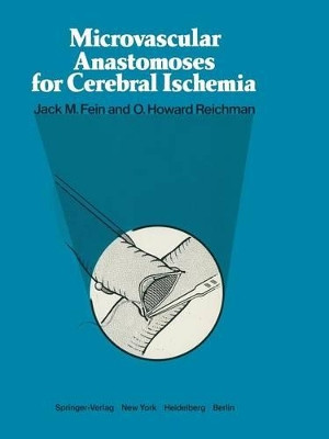Microvascular Anastomoses for Cerebral Ischemia by Jack M. Fein 9781461299134