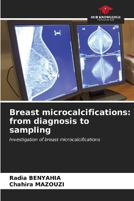 Breast microcalcifications: from diagnosis to sampling by Radia Benyahia 9786207035533