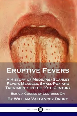 Eruptive Fevers: A History of Medicine - Scarlet Fever, Measles, Small-Pox and Treatments in the 19th Century - Being a Course of Lectures On by William Vallancey Drury 9781789870817