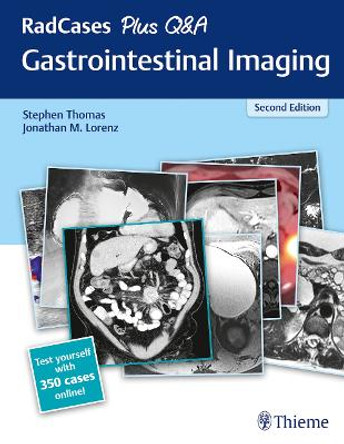 Radcases Gastrointestinal Imaging by Stephen Thomas