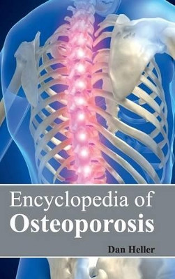 Encyclopedia of Osteoporosis by Dan Heller 9781632421692