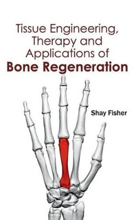 Tissue Engineering, Therapy and Applications of Bone Regeneration by Shay Fisher 9781632413710