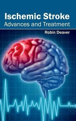 Ischemic Stroke: Advances and Treatment by Robin Deaver 9781632412713