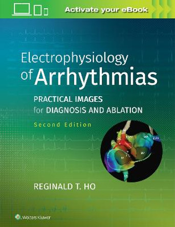 Electrophysiology of Arrhythmias: Practical Images for Diagnosis and Ablation by Reginald T. Ho