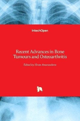 Recent Advances in Bone Tumours and Osteoarthritis by Hiran Amarasekera 9781839689239