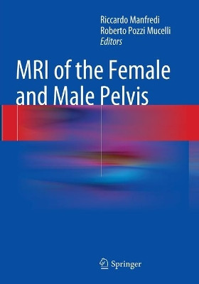 MRI of the Female and Male Pelvis by Riccardo Manfredi 9783319355597