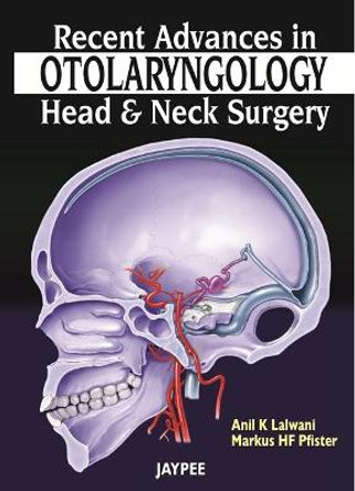 Recent Advances in Otolaryngology - Head and Neck Surgery by Anil K. Lalwani