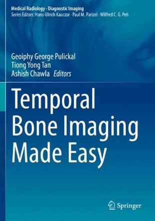 Temporal Bone Imaging Made Easy by Geoiphy George Pulickal 9783030706371