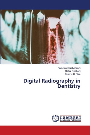 Digital Radiography in Dentistry by Namrata Harchandani 9786207996735