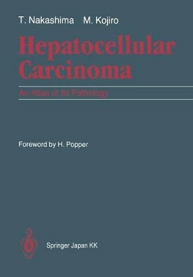 Hepatocellular Carcinoma: An Atlas of Its Pathology by H. Popper 9784431683360