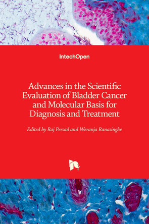 Advances in the Scientific Evaluation of Bladder Cancer and Molecular Basis for Diagnosis and Treatment by Raj Persad 9789535111429