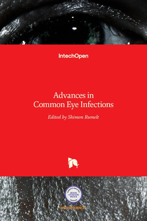 Advances in Common Eye Infections by Shimon Rumelt 9789535128090