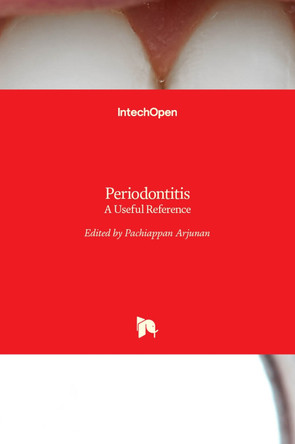 Periodontitis: A Useful Reference by Pachiappan Arjunan 9789535136057
