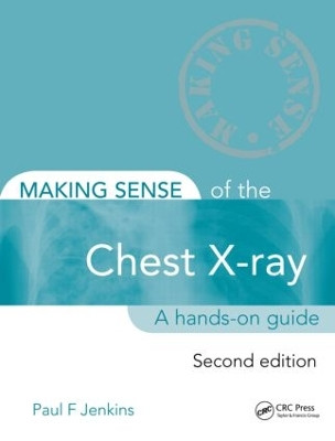 Making Sense of the Chest X-ray: A hands-on guide by Paul Jenkins 9781444135152