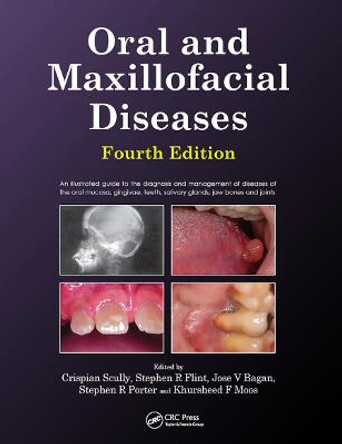 Oral and Maxillofacial Diseases, Fourth Edition by Crispian Scully