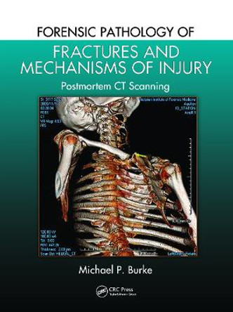 Forensic Pathology of Fractures and Mechanisms of Injury: Postmortem CT Scanning by Michael P. Burke