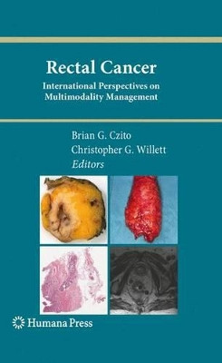 Rectal Cancer: International Perspectives on Multimodality Management by Brian G. Czito 9781617796951