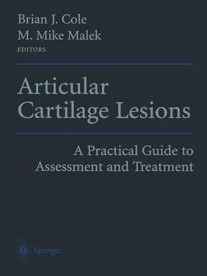 Articular Cartilage Lesions: A Practical Guide to Assessment and Treatment by Brian J. Cole 9781475792898
