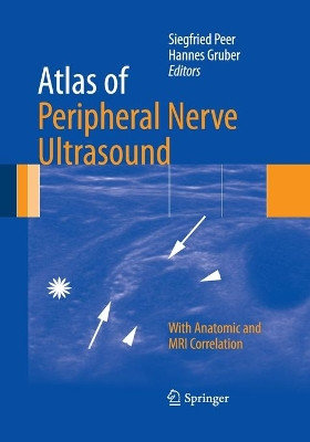 Atlas of Peripheral Nerve Ultrasound: With Anatomic and MRI Correlation by Siegfried Peer 9783662520550