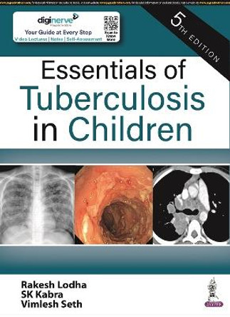 Essentials of Tuberculosis in Children by Rakesh Lodha 9789354657627