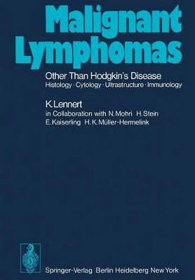 Malignant Lymphomas Other than Hodgkin's Disease: Histology * Cytology * Ultrastructure * Immunology by Karl Lennert 9783642810947