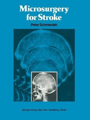 Microsurgery for Stroke by Peter Schmiedek 9781461263517