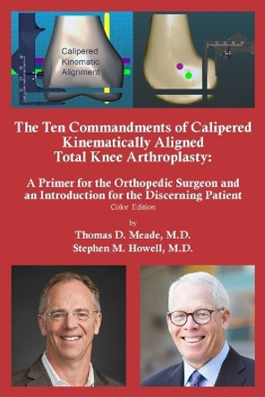 The Ten Commandments of Calipered Kinematically Aligned Total Knee Arthroplasty by Thomas D Meade 9781961879003
