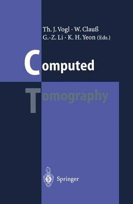 Computed Tomography: State of the Art and Future Applications by Thomas J. Vogl 9783642798894