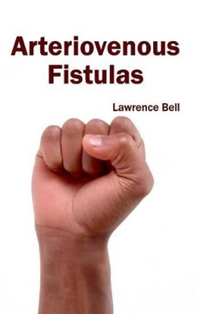 Arteriovenous Fistulas by Lawrence Bell 9781632410498