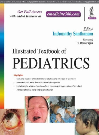 Illustrated Textbook of Pediatrics by Indumathy Santhanam 9789352701025