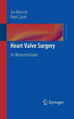 Heart Valve Surgery: An Illustrated Guide by Jan Dominik 9783662505717