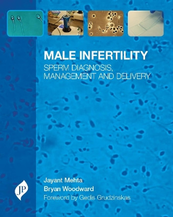 Male Infertility: Sperm Diagnosis, Management and Delivery by Jayant Mehta 9781907816468