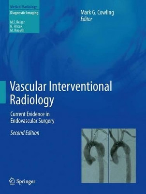 Vascular Interventional Radiology: Current Evidence in Endovascular Surgery by Mark G. Cowling 9783642436680