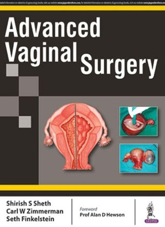 Advanced Vaginal Surgery by Shirish S. Sheth 9789352700172