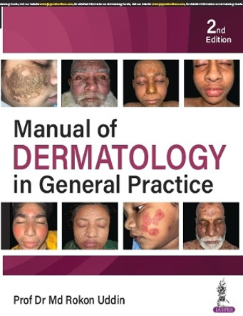 Manual of Dermatology in General Practice by Rokon Uddin 9789356968530